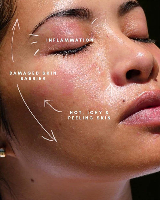 Skin Restore Capsules