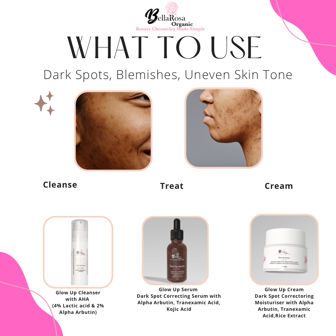 30ml Glow Up Dark Spot Correcting Serum