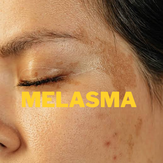 MELASMA COMPLETE NIGHT COMBO