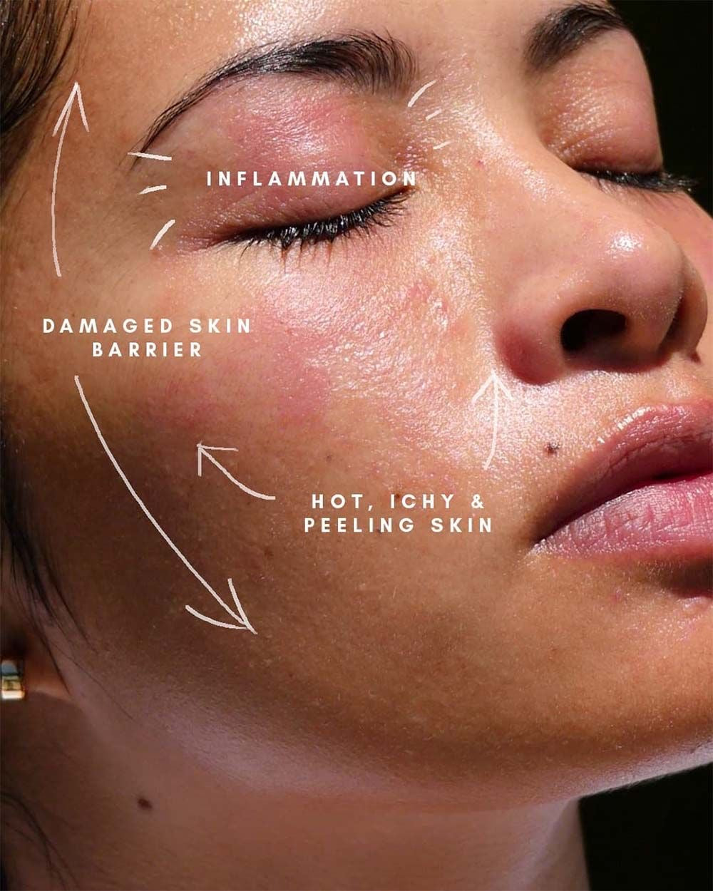 Skin Restore Capsules