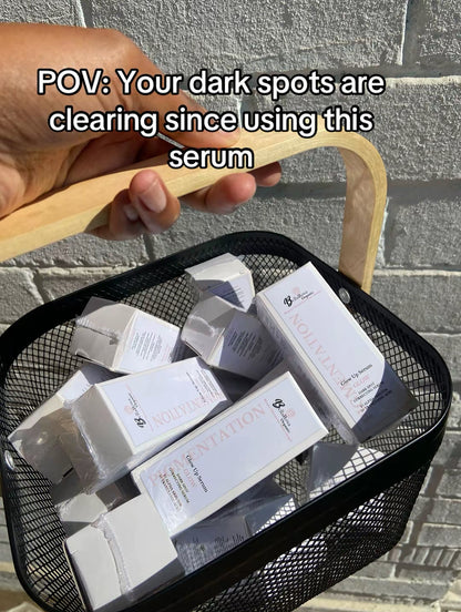 30ml Glow Up Dark Spot Correcting Serum